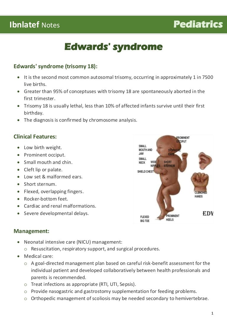 Why do children suffer from Edwards syndrome Why do children suffer from Edwards syndrome